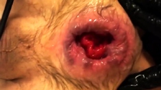 Anal orgasms from fisting